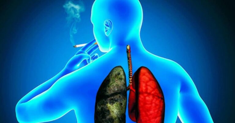 Research Will Identify Needs and Barriers of Lung Cancer Patients in Costa Rica